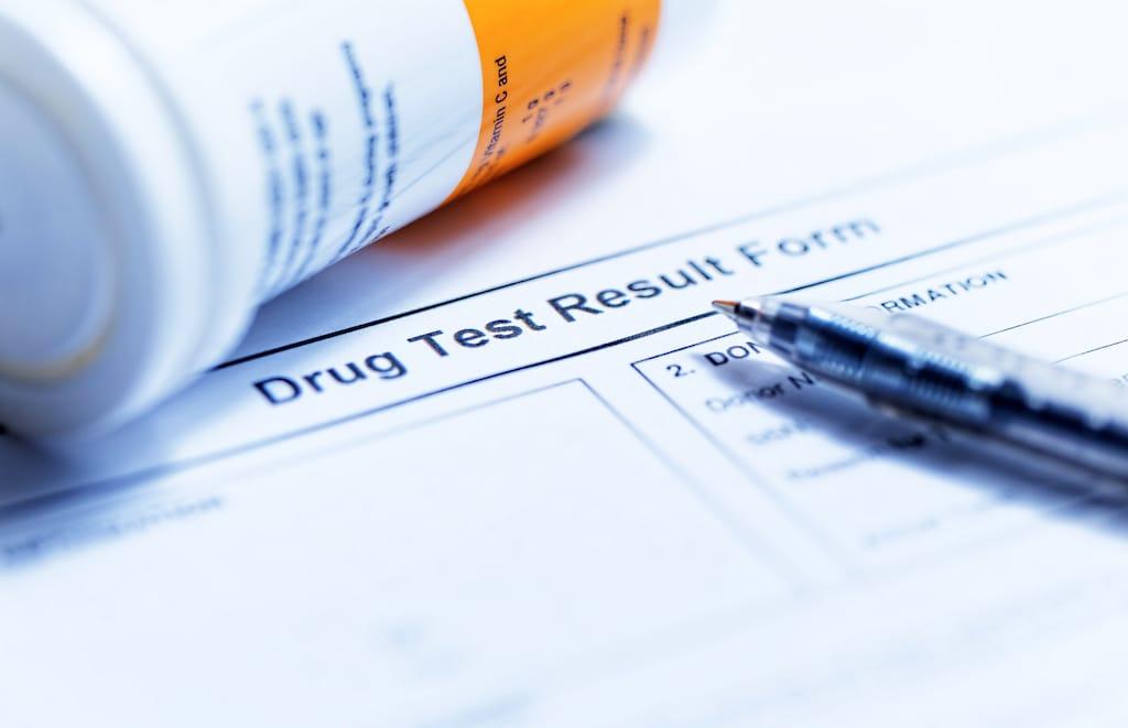 Pre-employment drug testing